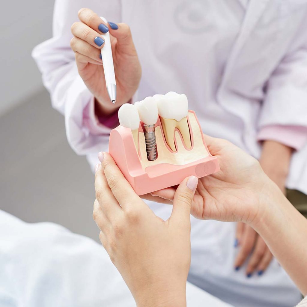 Close up of dental implants at doctors office