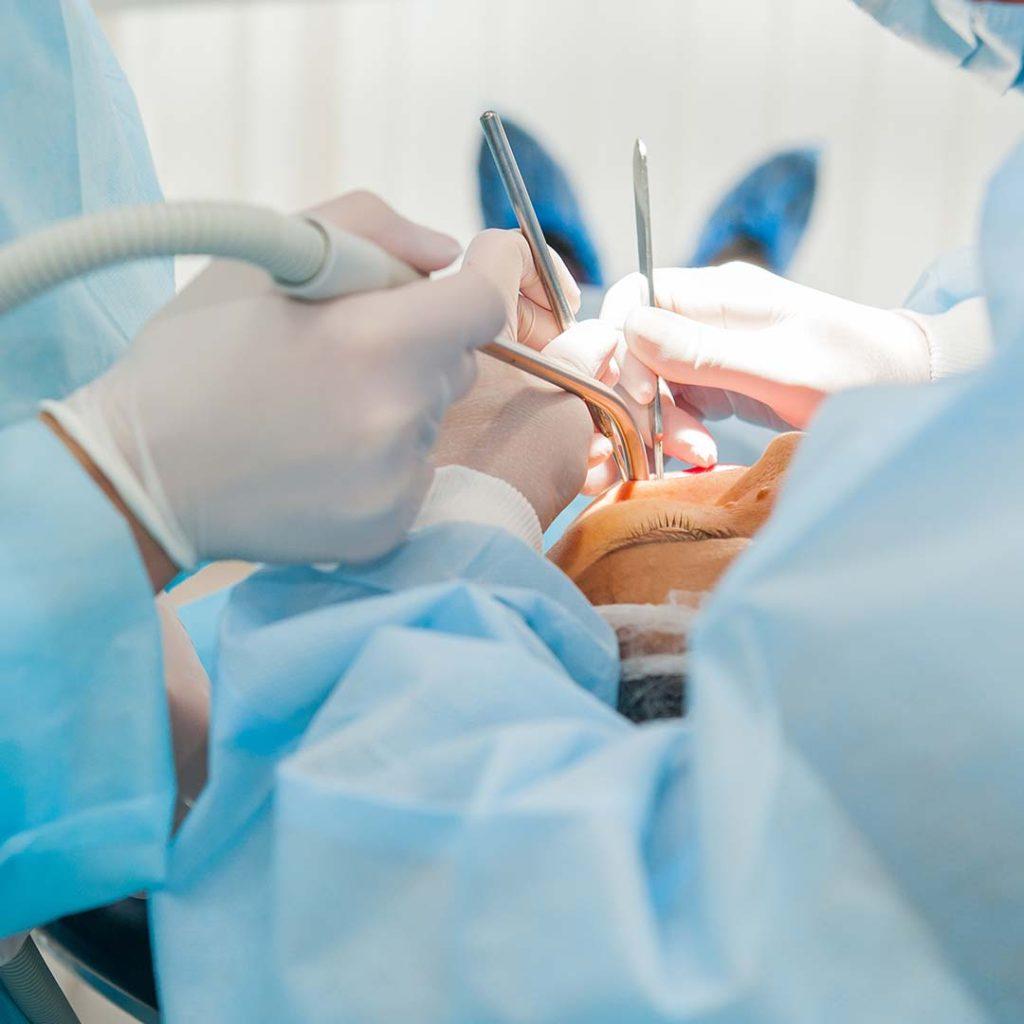 Dentist performing oral surgery at Elite Dental & Wellness in Mesa, AZ